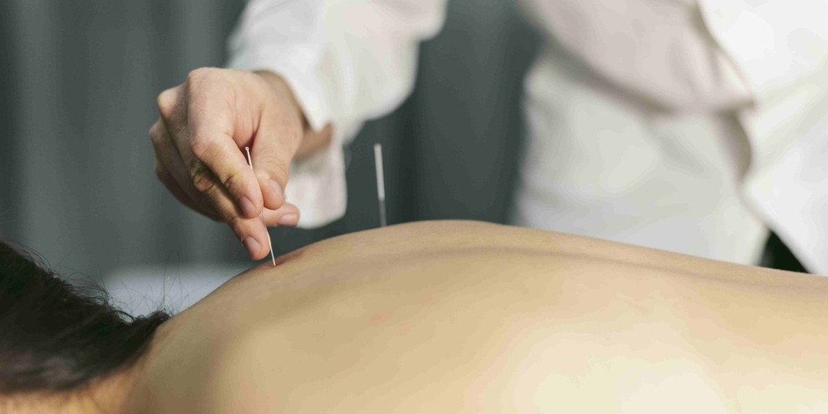 Acupuncture & Wellness for IVF in Newport Beach CA