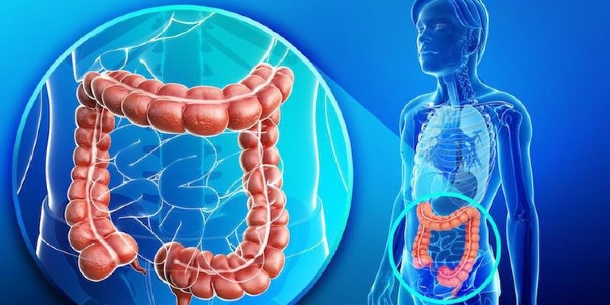 Bangalore’s Expert in Colorectal & Laparoscopic Surgery – Dr. Bhushan