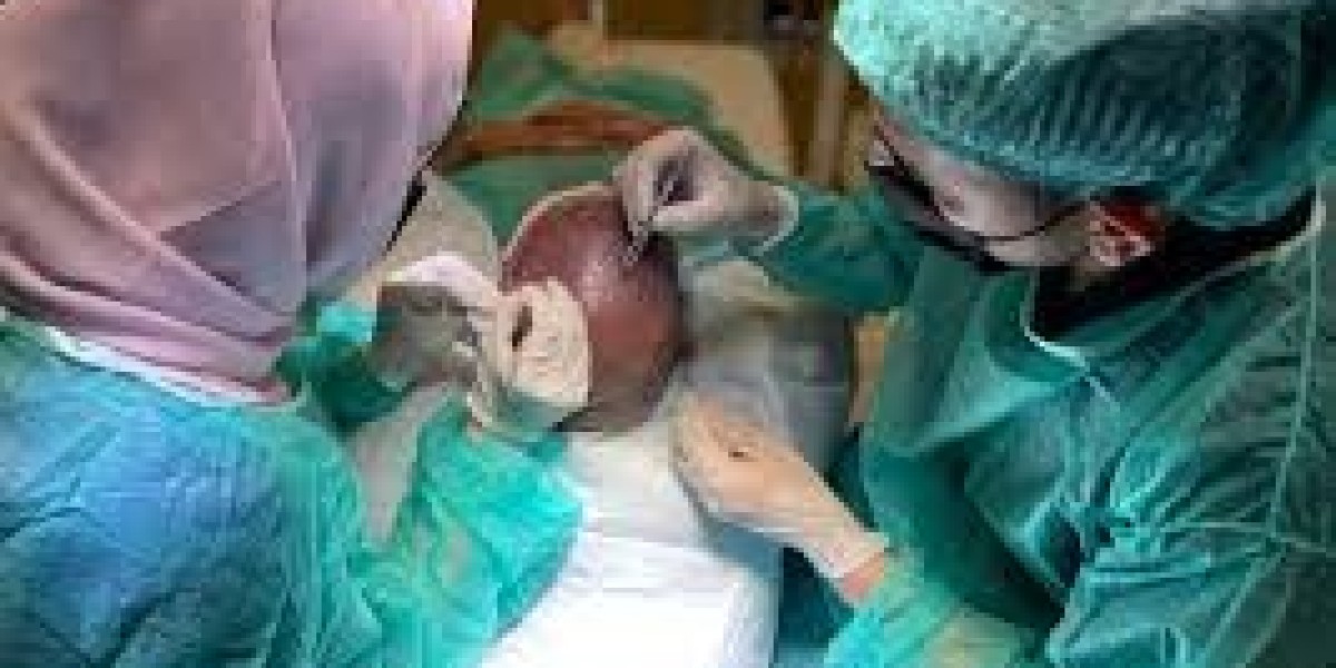 Hair Transplant in Dubai: Is It Painful? Myths vs. Reality