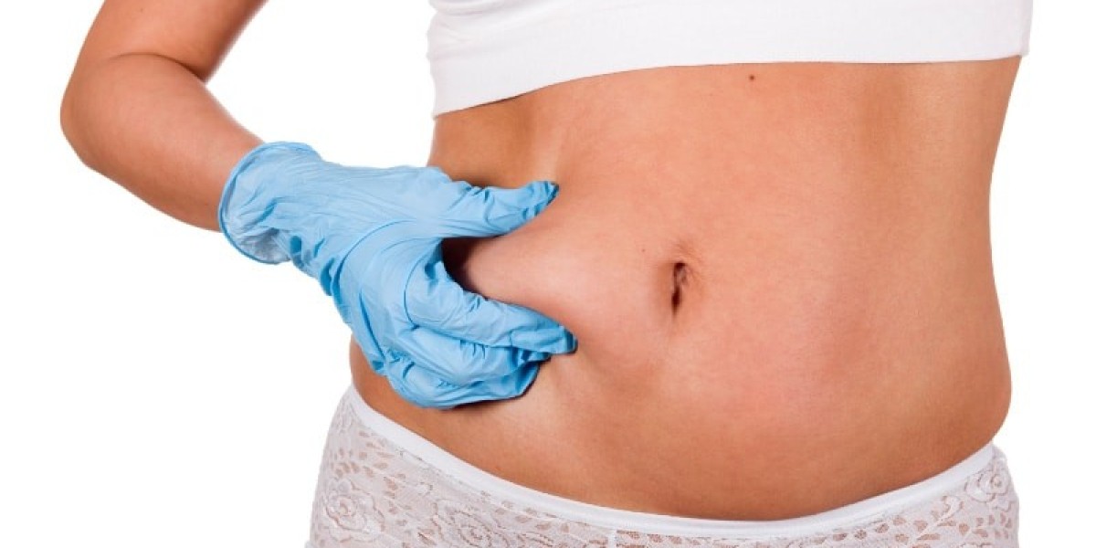 Liposuction Recovery Tips for Safe and Smooth Healing