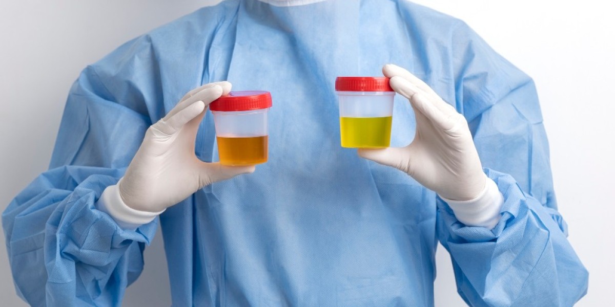 Organ Preservation Solution Market Insights 2024: Innovations, Key Players, and Future Outlook