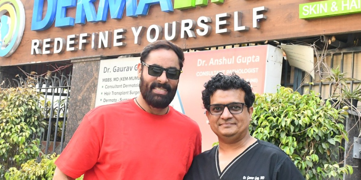 Struggling with Baldness? Discover the Most Advanced Hair Transplant Solutions in Delhi