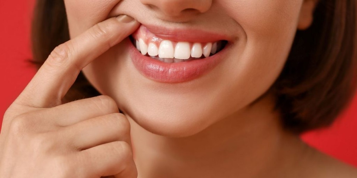 Is Gum Depigmentation Covered by Insurance?