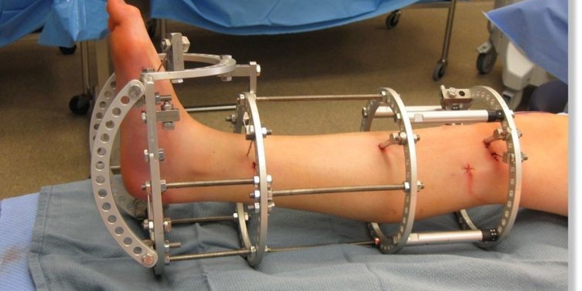 Strategic Outlook on Limb Lengthening Surgery Market Size Growth and End User Applications
