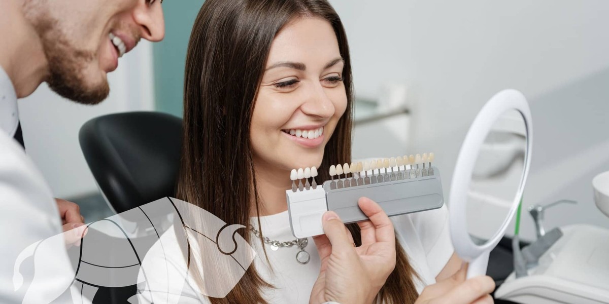 The Step-by-Step Process of Getting Non-Prep Veneers