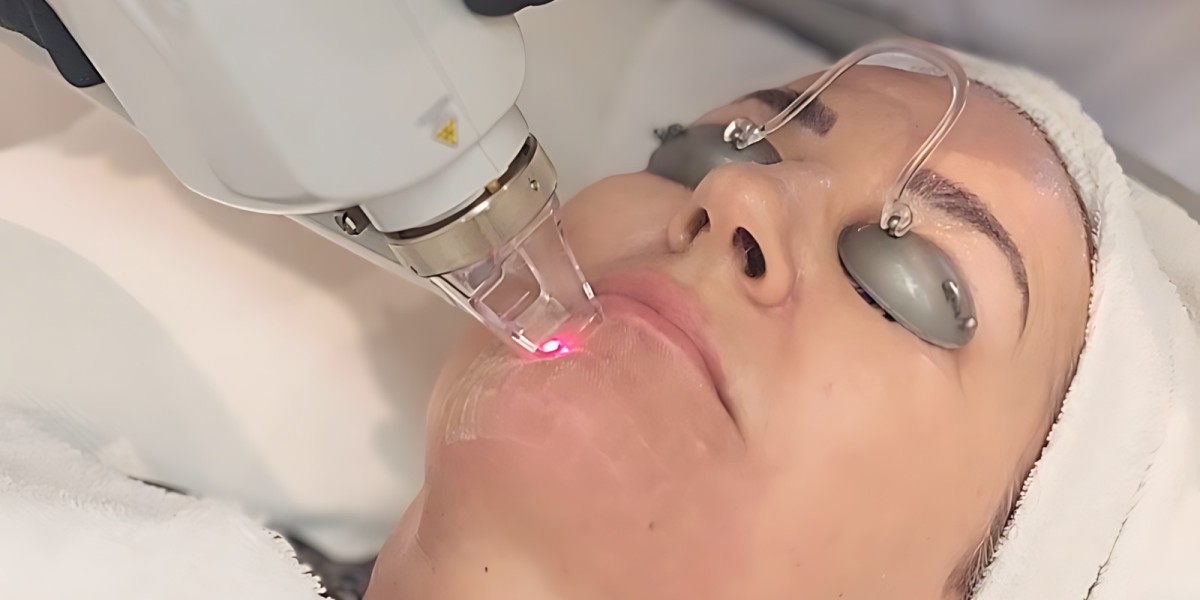 Fractional CO2 Laser Treatment Cost and How to Maximize Results
