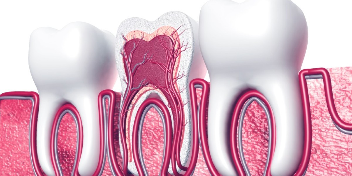 Biocompatible Materials Used in Islamabad’s Root Canal Treatments