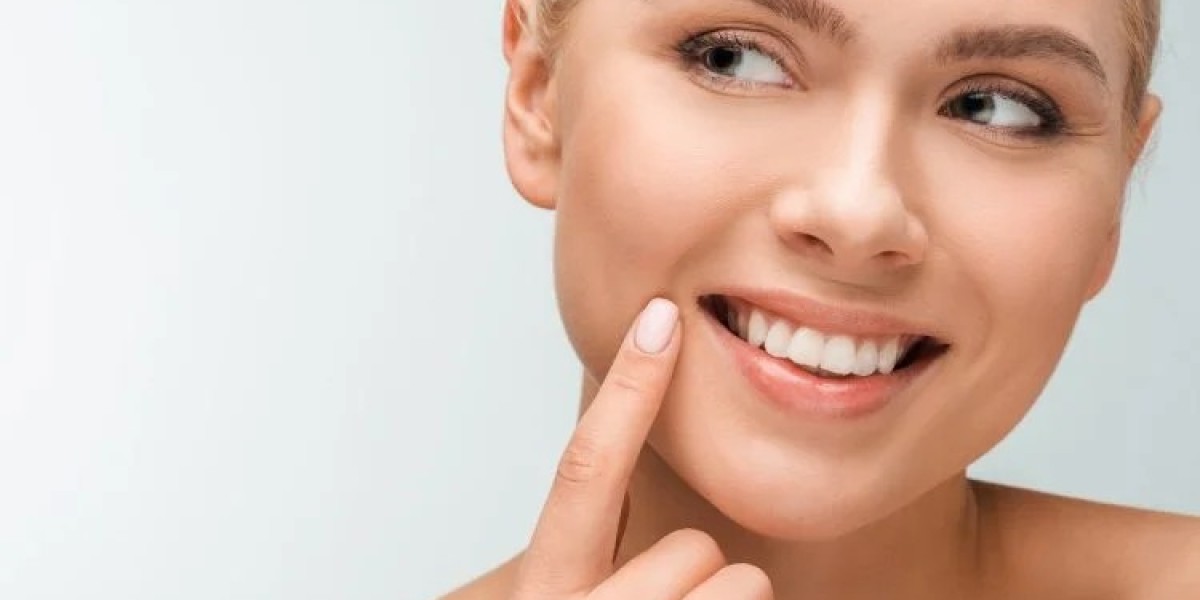 The Rise of Composite Bonding in Cosmetic Dentistry