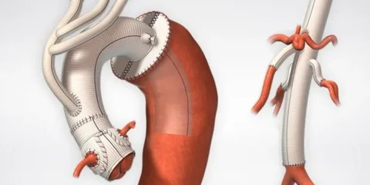 Rising Demand for Vascular Patches Market to Exceed $256M by 2034