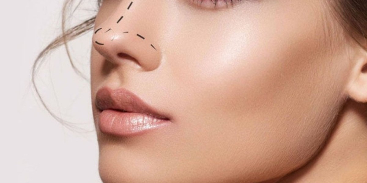 How Long Does Rhinoplasty Recovery Take