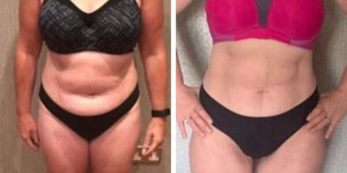 Discover the Best Weight Loss Plans Ireland Has to Offer – Now Available in the USA