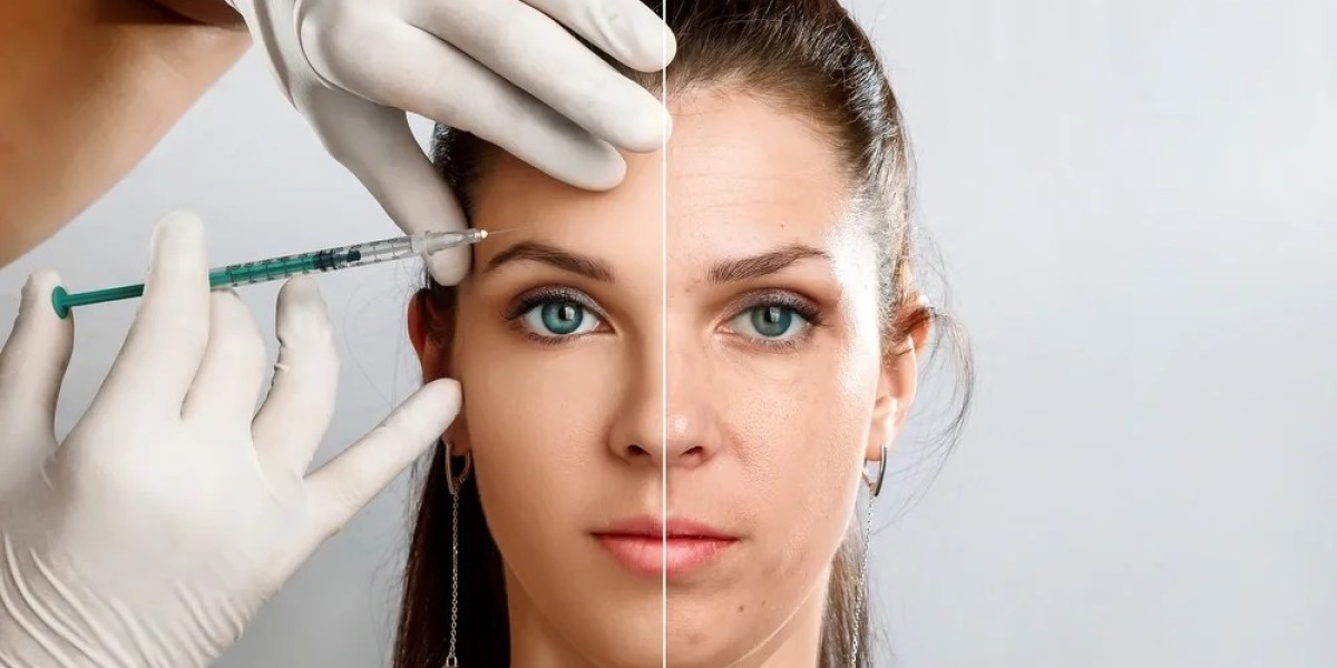 Flawless and Full Look with Dermal Fillers Injections in Dubai