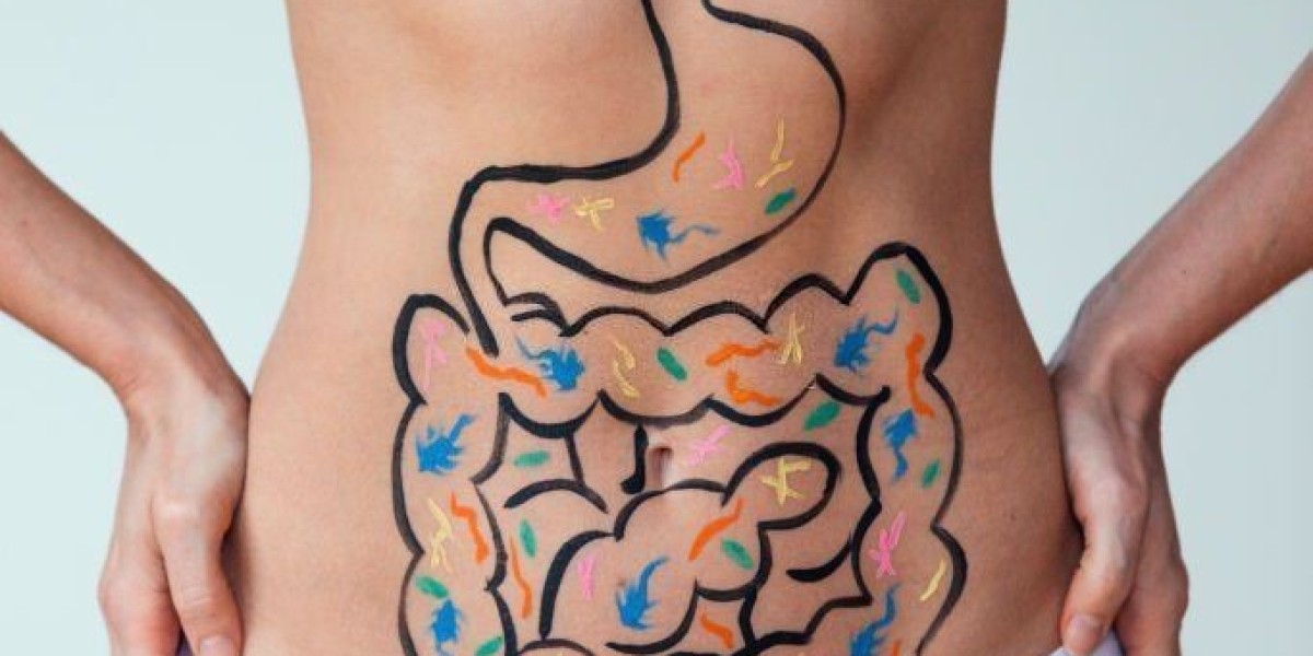 Life After Obesity Surgery in Riyadh: A New You