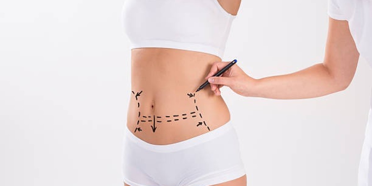 Tummy Tuck in Dubai: Your New Shape