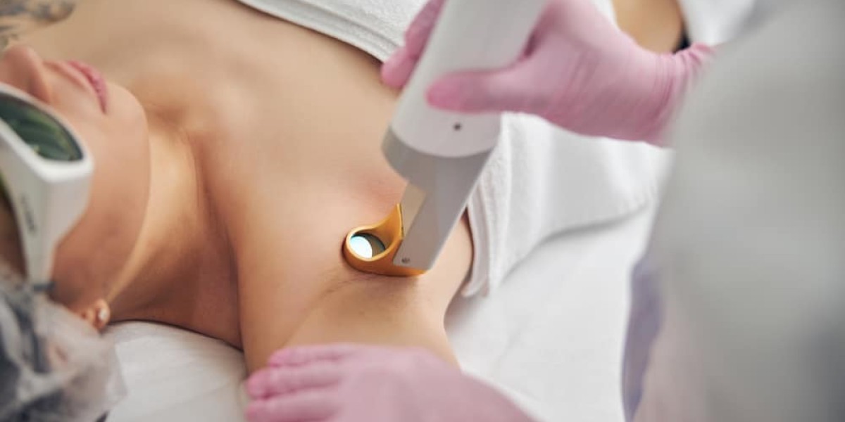 Laser Hair Removal for a Carefree Lifestyle