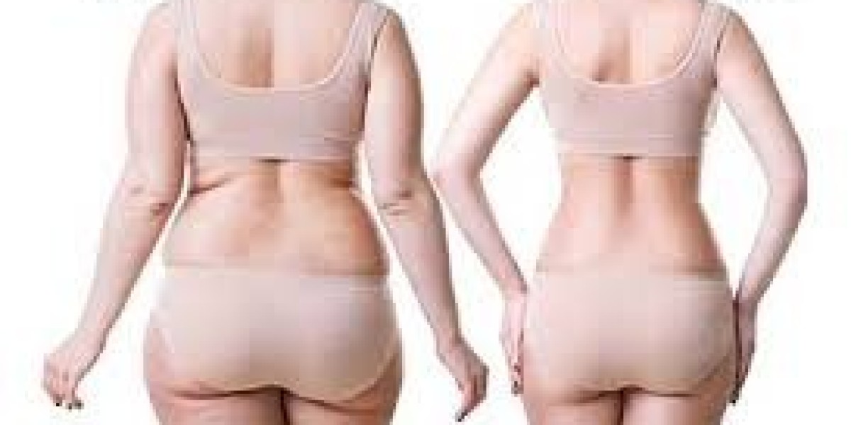 The Complete Guide to Breast Implants, Vagina Tightening, and Tummy Tuck Surgery in Gurgaon by Dr. Amit Gupta
