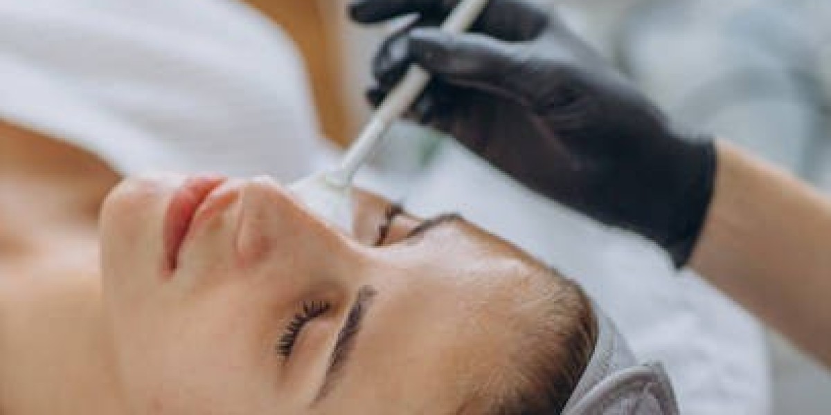 Chemical Peels in Dubai: Top Clinics for Radiant Skin