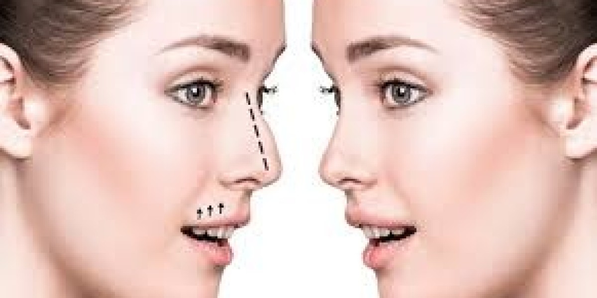 Common Myths About Rhinoplasty in Dubai – Debunked!