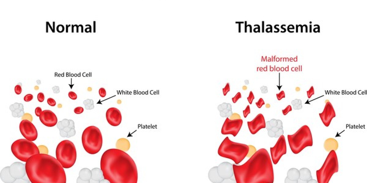 Global Beta-Thalassemia Market Insights, Drivers, and Future Scope Report 2030