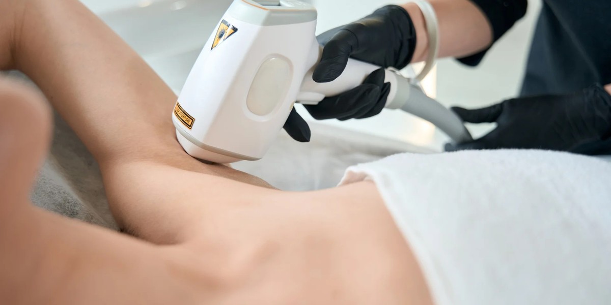 What Lasers Are Used in Laser Hair Removal?