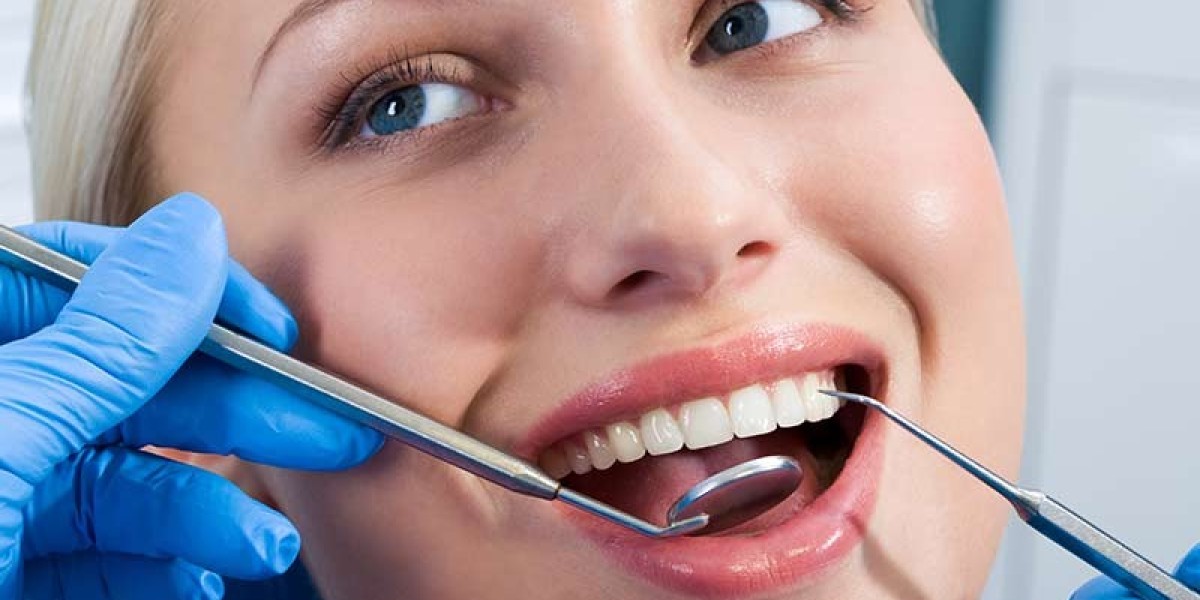 Single Tooth Veneers: Correcting Isolated Imperfections