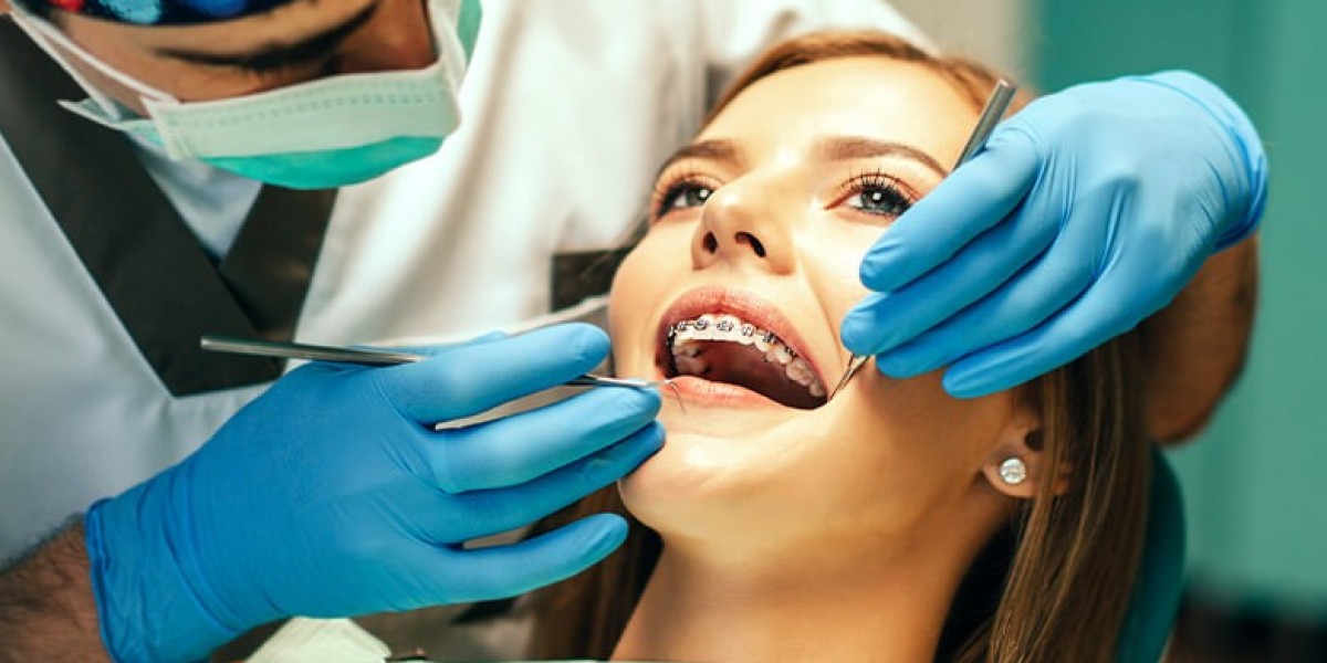 Digital Scanning vs. Traditional Impressions: Which Is Better?
