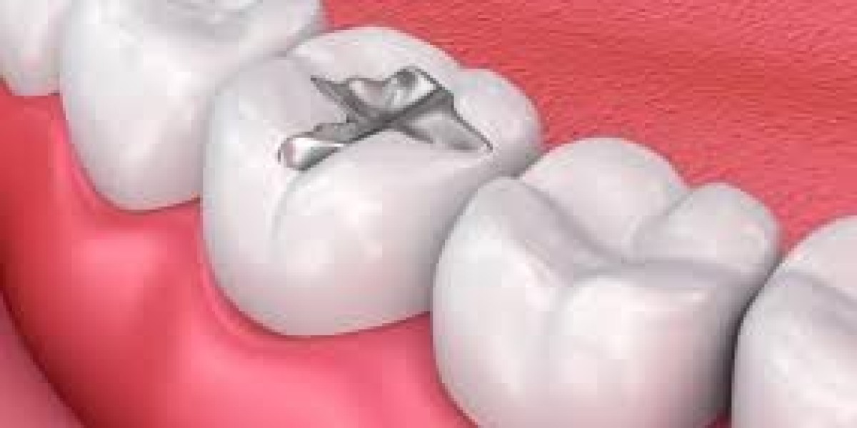Tooth Filling Materials Market Analysis by Type, Application, and Regional Forecast till 2030