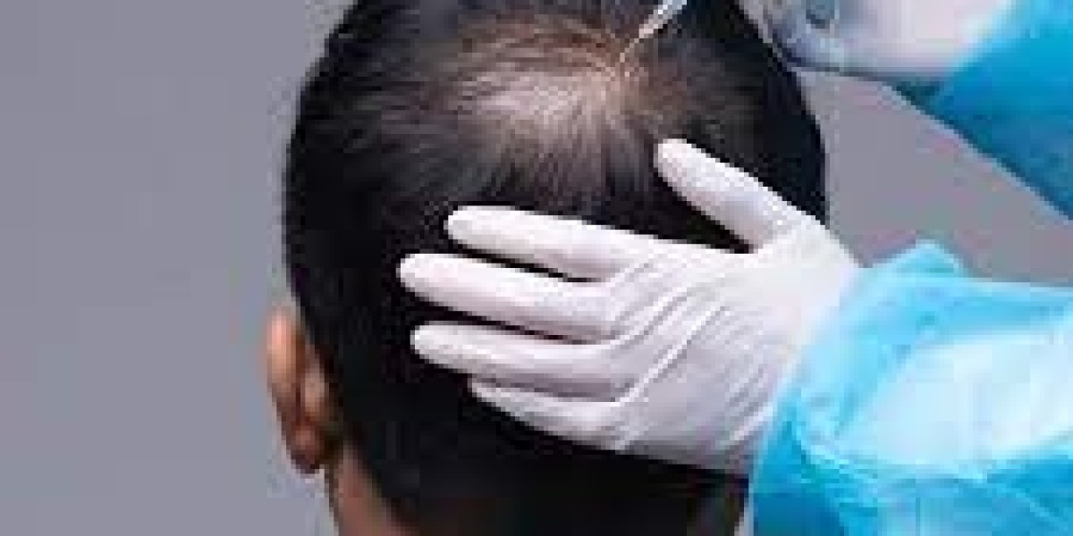 From Thinning to Thriving: PRP in Abu Dhabi
