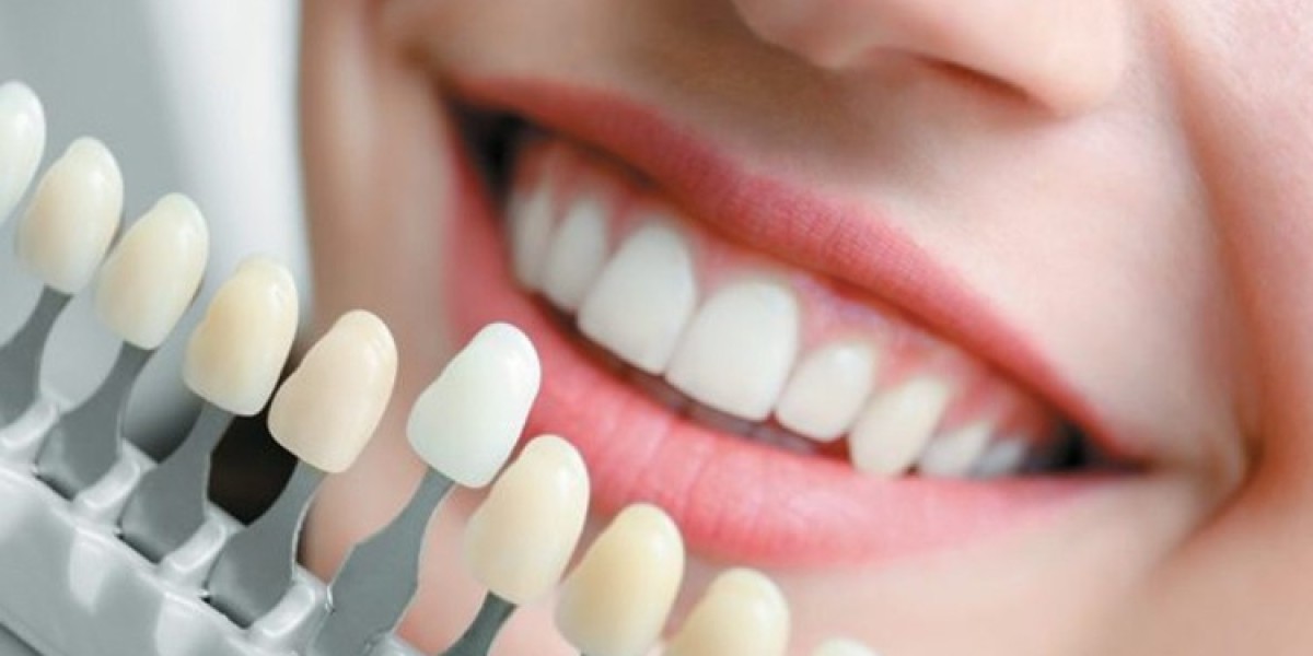 Smiling in Style: How Your Smile Completes Your Look