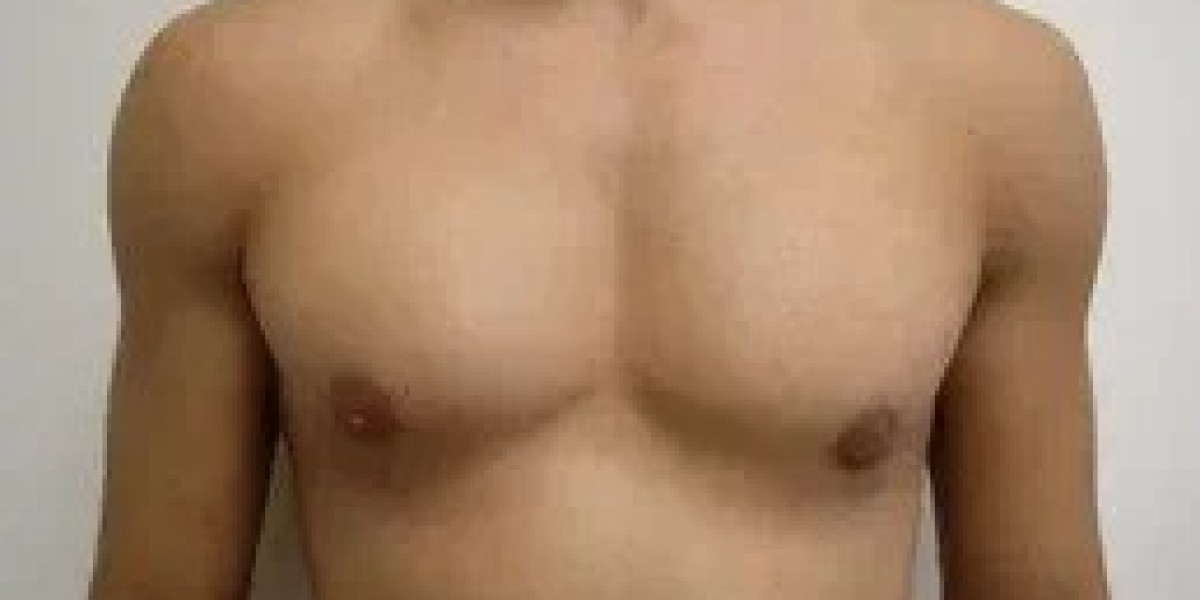 Male Chest Surgery for Gynecomastia in Riyadh