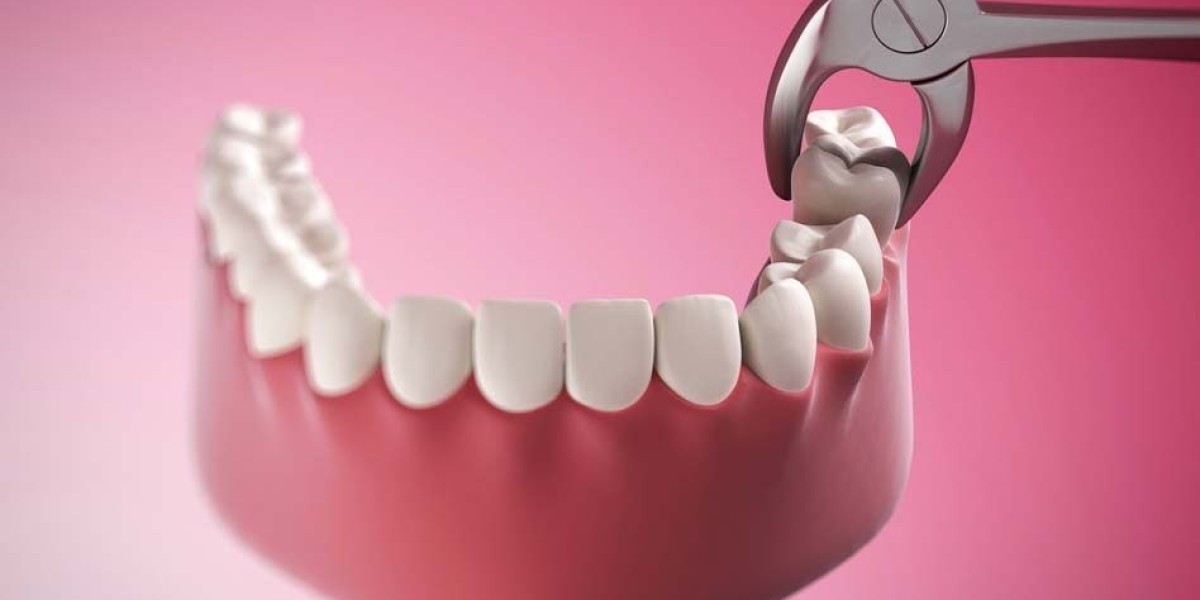 Nhổ răng khôn chảy máu bao lâu? Khi nào là dấu hiệu bất thường
