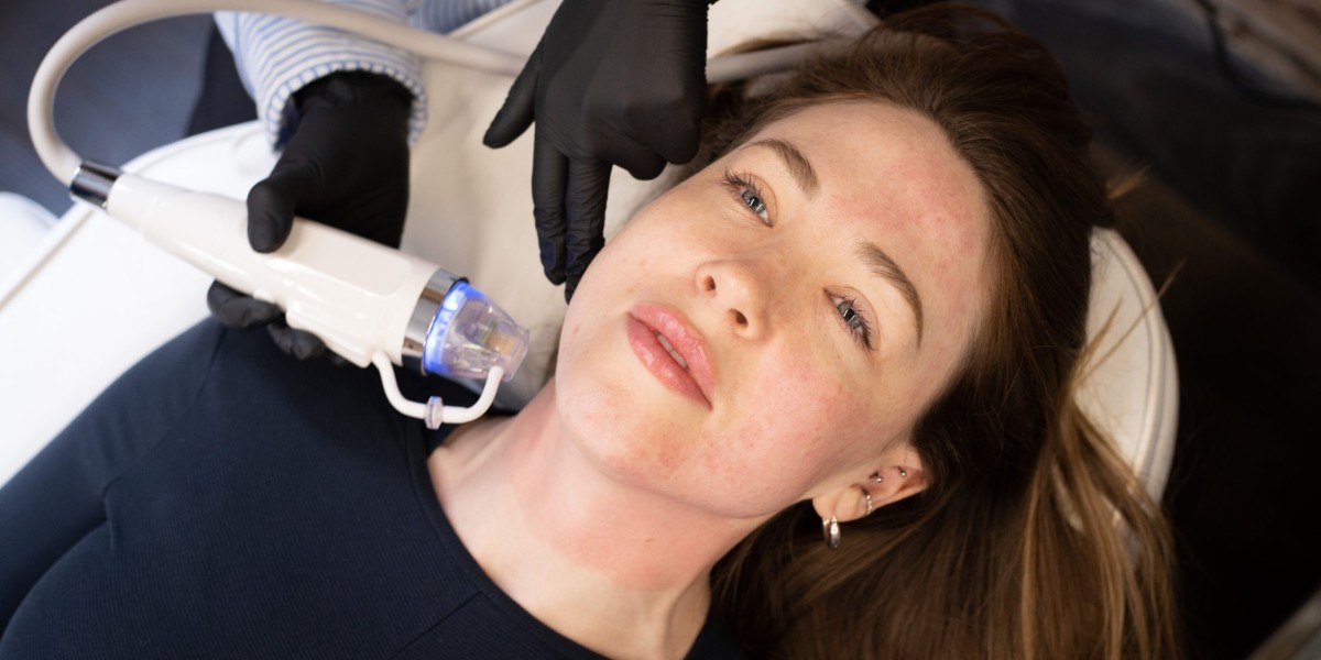 Repair. Revive. Renew with Fractional RF Microneedling!