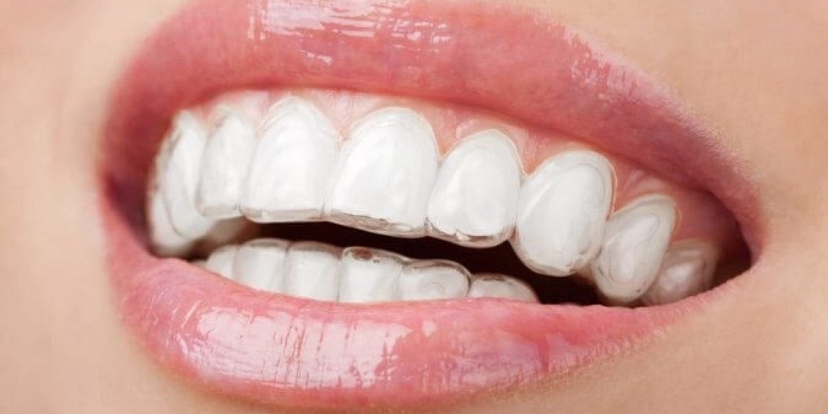 Understanding the Different Types of Aligners on the Market Today