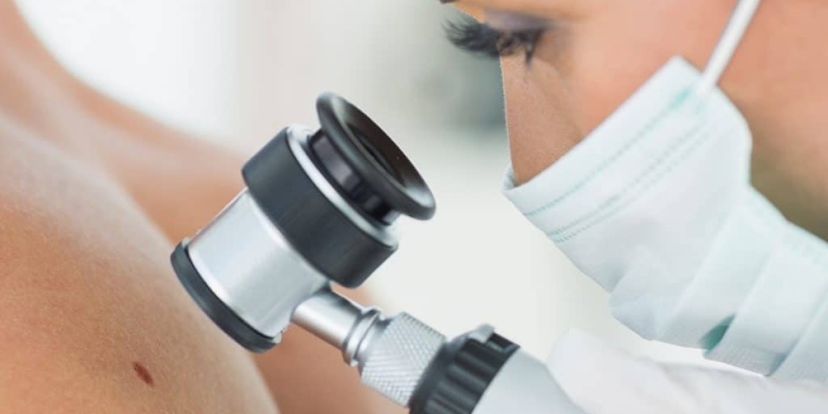 What Is Dermoscopy Mole Evaluation Used For?