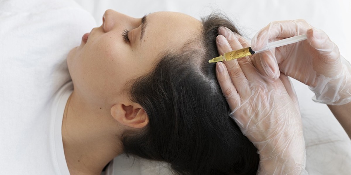 GFC Hair Treatment in Dubai for Bald Patches: Can It Reverse Damage?