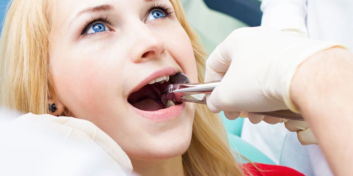 Nhổ Răng Khôn Cần Kiêng Gì? Hướng Dẫn Chi Tiết Sau Nhổ