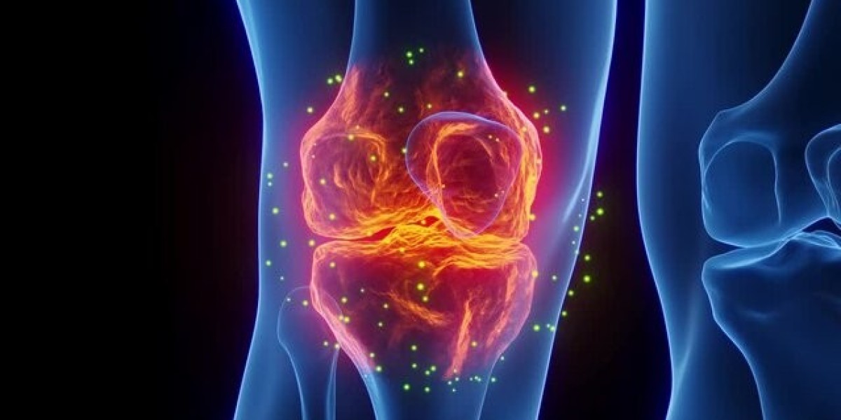 Knee Osteoarthritis Market Size, Growth, and Strategic Outlook 2025-2032
