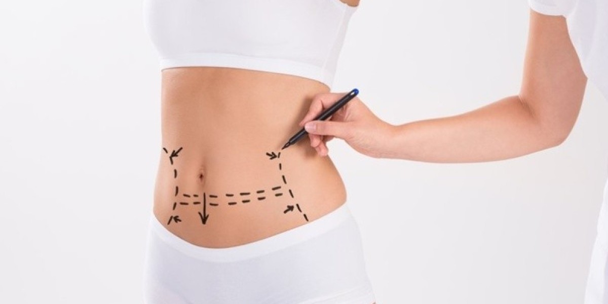 Tummy Tuck vs Liposuction in Islamabad: What’s the Difference?