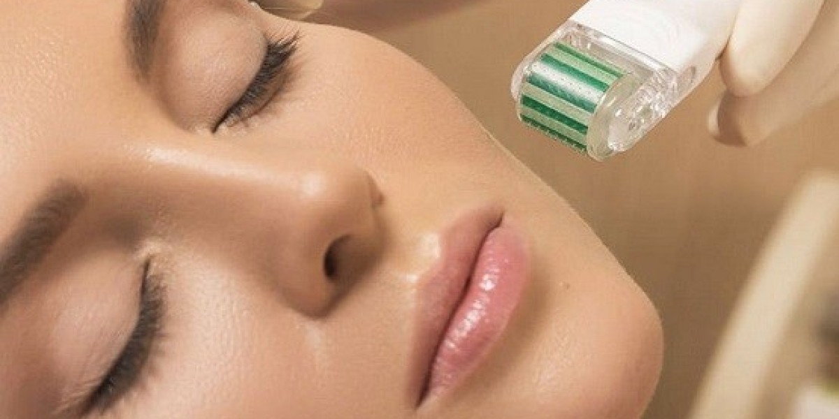 Micro-needling for acne scars: Dermatologist advice