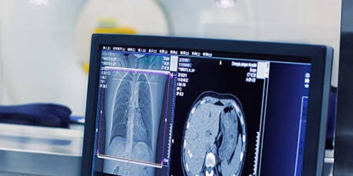 Affordable Imaging Solutions: Shop a Used X-ray Machine Today