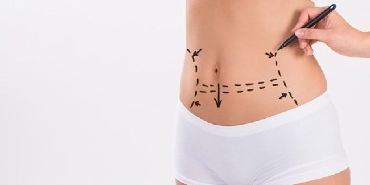 How to Sleep Comfortably After a Tummy Tuck