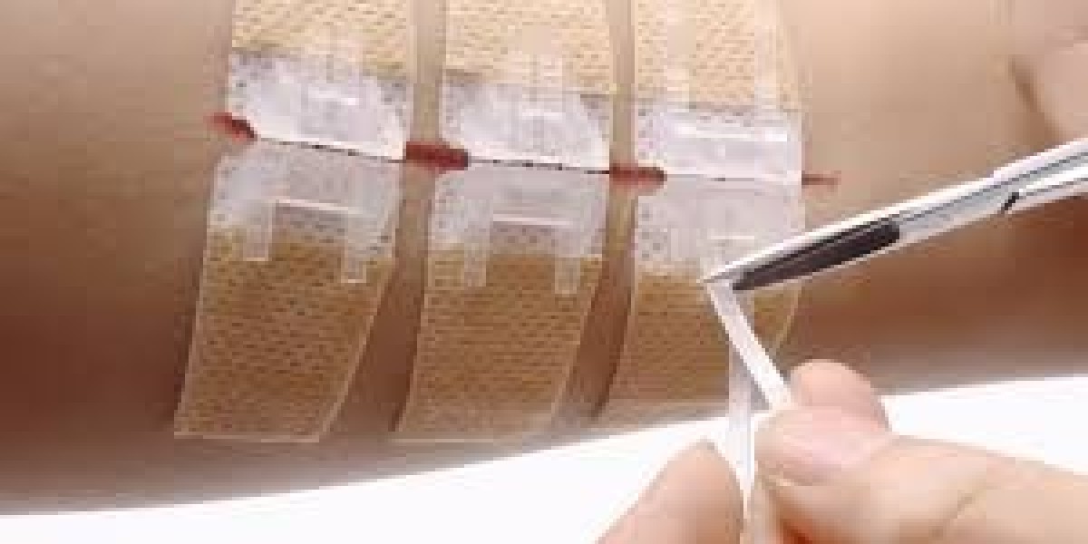 Non-invasive Surgical Wound Closure Market expected to benefit from aging population and chronic wound cases