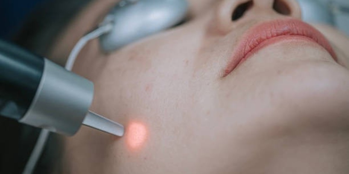 Laser Hair Removal in Riyadh for All Skin Types: Laser Hair Removal vs. Waxing in Riyadh: Which Is Better for You?