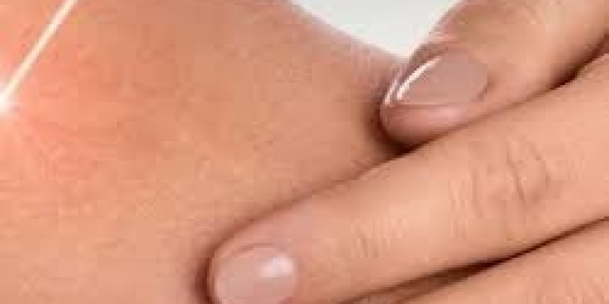 Comparing Scar Removal Treatments in Dubai: Which Method Is Right for You?