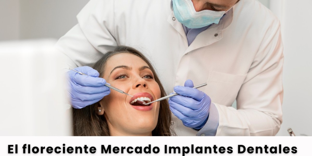 El floreciente Mercado Implantes Dentales