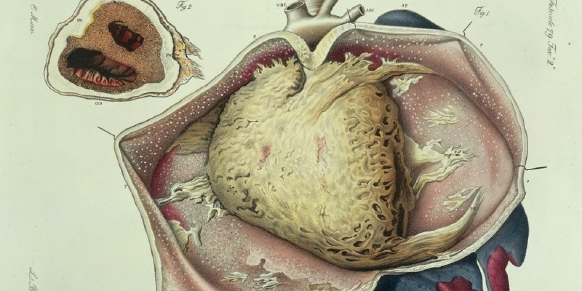 Recurrent Pericarditis Market Size, Trends, and Strategic Outlook 2025-2032