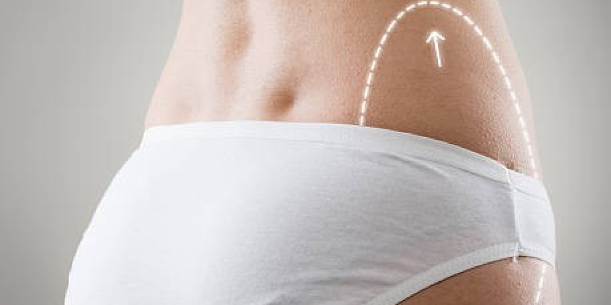 BodyTite in Dubai: The Ultimate Solution for Body Contouring