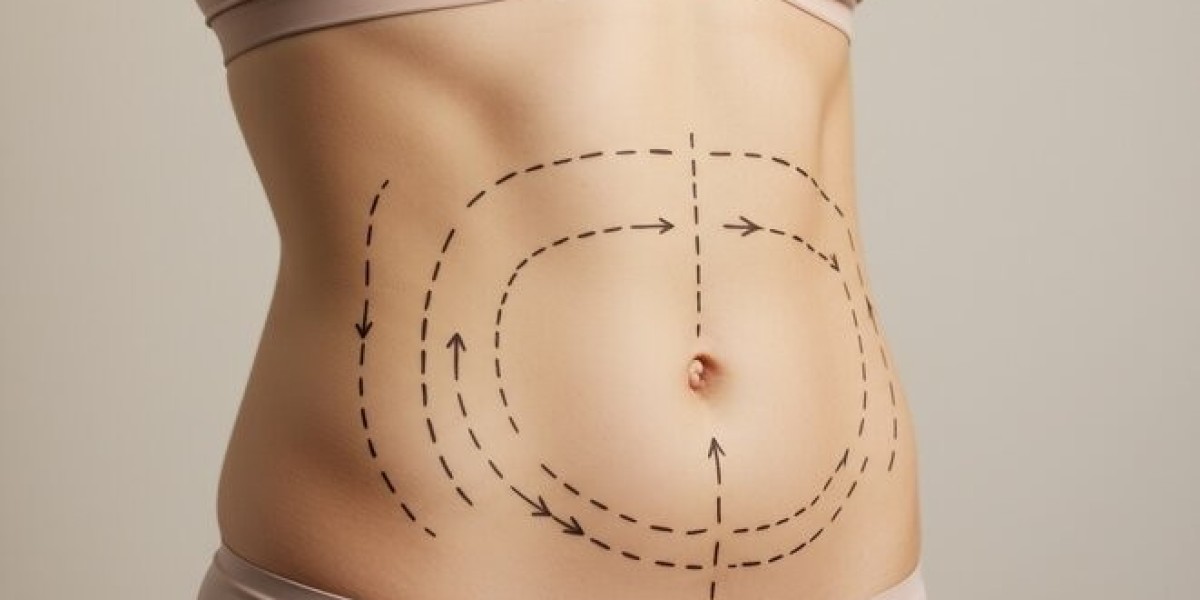 Real Patient Reviews of Mini Abdominoplasty in Dubai