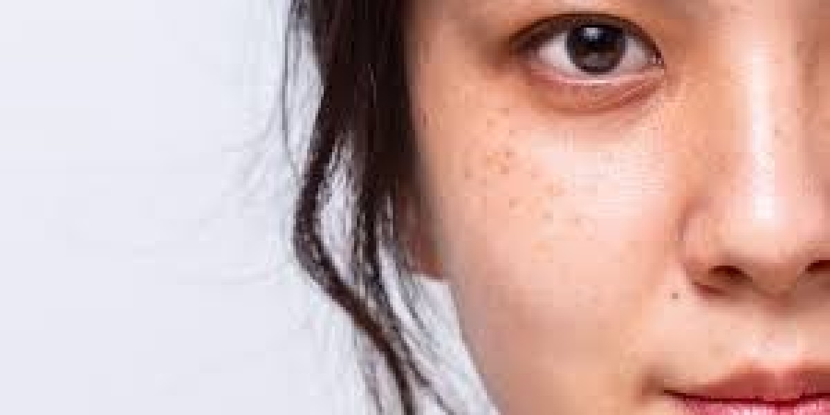 Revive Your Skin with Pico Laser Treatment in Islamabad