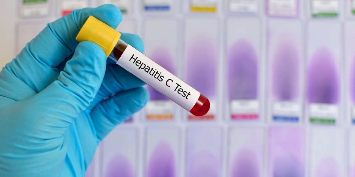Can I book Hepatitis C test in Dubai?
